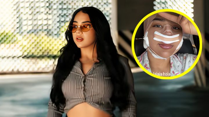 Lady Pays reaparece irreconocible tras someterse a varias cirugías estéticas