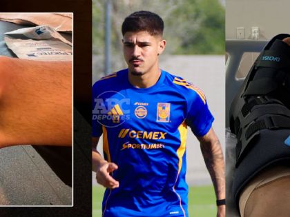 Rómulo Zwarg es operado del tobillo será baja entre cuatro y seis semanas