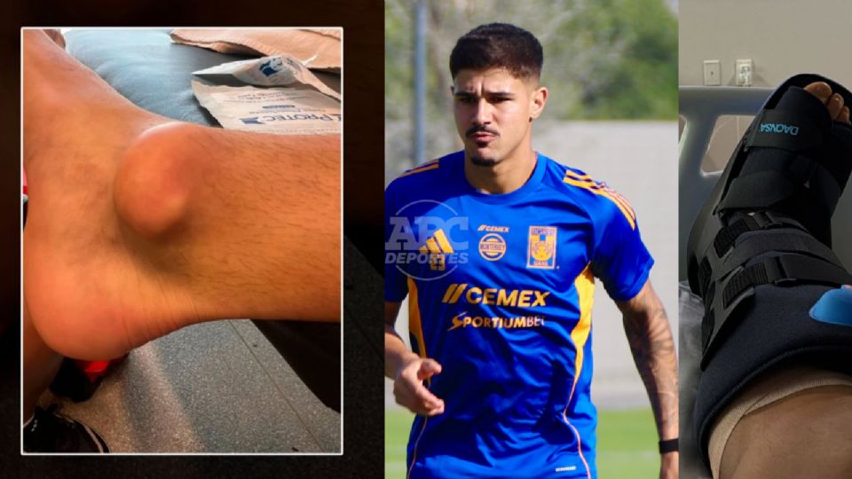 Zwarg fue operado del tobillo y ya inició recuperación.