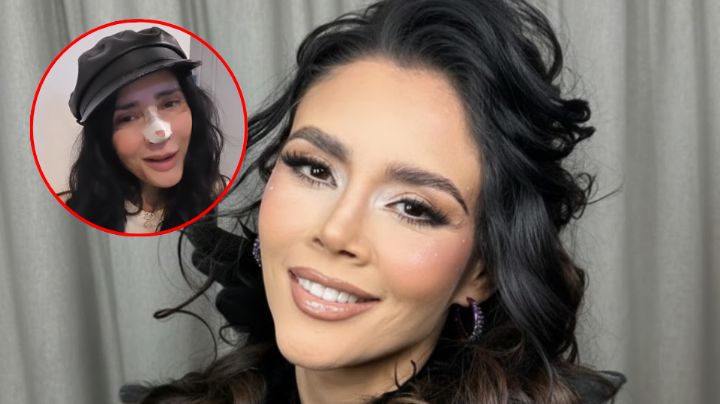 Dorismar muestra su nueva nariz tras cirugía reconstructiva