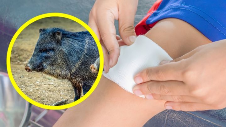 ¿Qué tan peligrosa es la mordida de un pecarí? Descubre cómo actuar