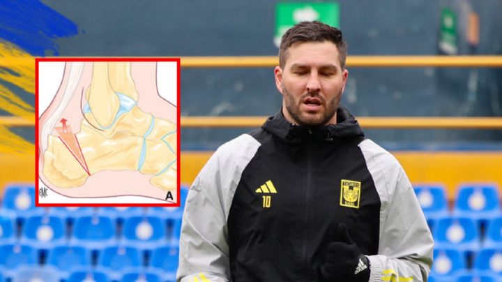 ¿Qué es la fibrosis, la razón por la que Gignac no jugará contra León?