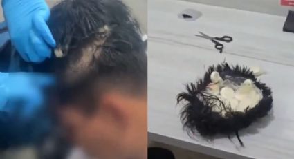 Detienen en Colombia a hombre con ‘narcopeluca’ donde guardaba cocaína