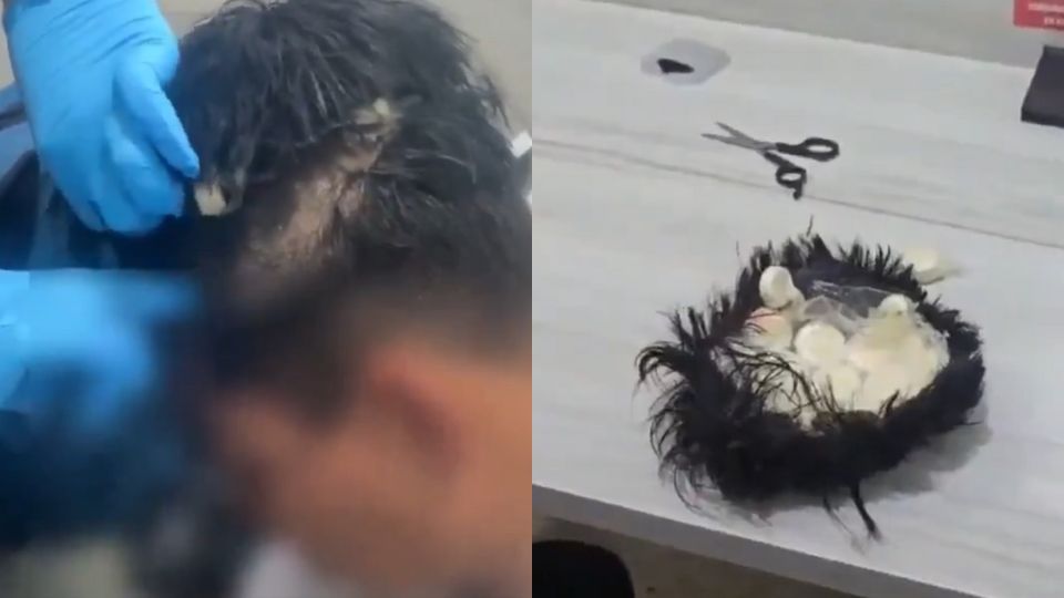 Capturan a hombre con droga en Colombia; la escondía en una peluca