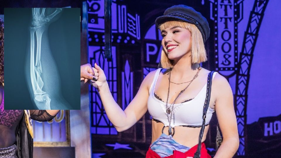 Eva Gary, actriz de Pretty Woman: El Musical, se rompe los brazos tras accidente | Facebook / Pretty Woman: The Musical