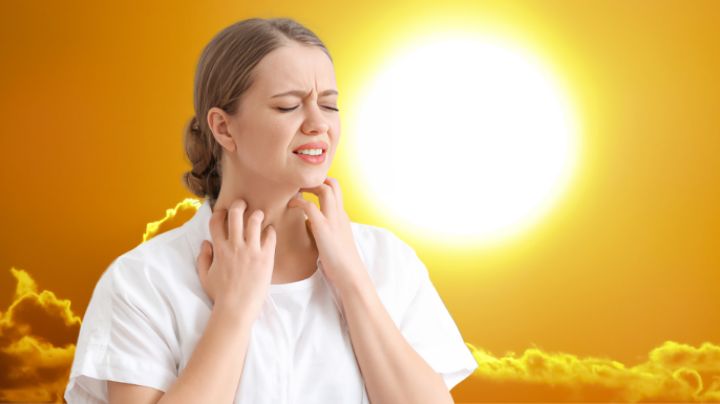 3 formas para saber si eres alérgico al sol ¿Cómo se puede tratar?