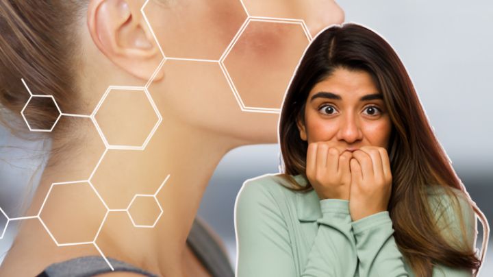¿Te salió una mancha en el rostro? Cuidado, podría ser indicador de estas enfermedades