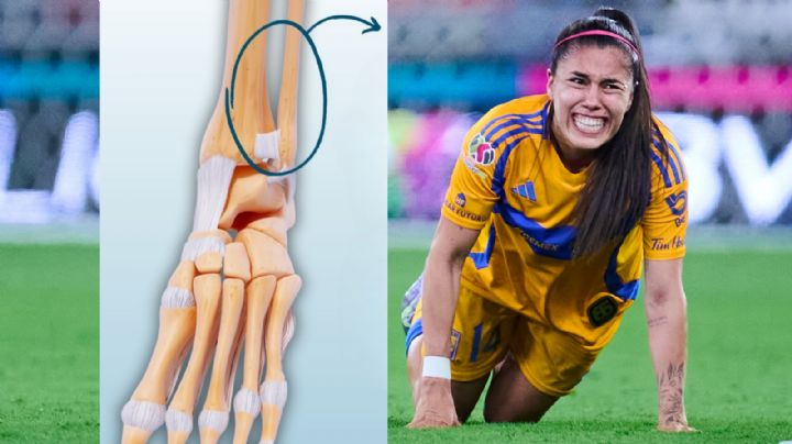 Descartan fractura de Ovalle; Tigres Femenil espera su recuperación para la Concachampions