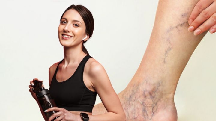 3 ejercicios que ayudan a reducir el dolor de várices en las piernas, según expertos