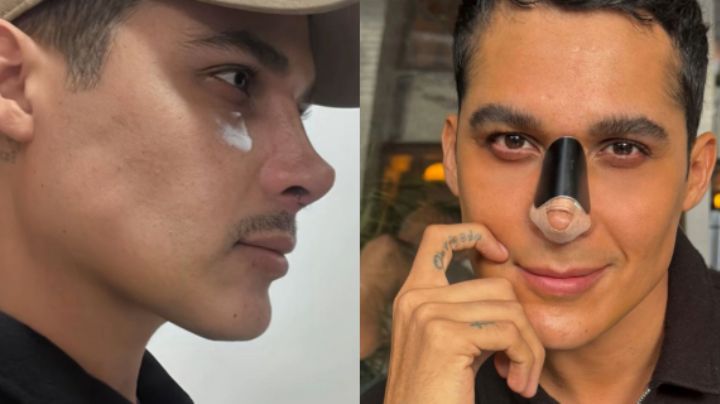 Luis Torres responde a burlas por el resultado de su rinoplastia