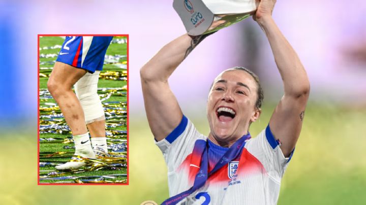 Lucy Bronze jugó la Eurocopa Femenil 2025 con la pierna fracturada y llevó a Inglaterra al título