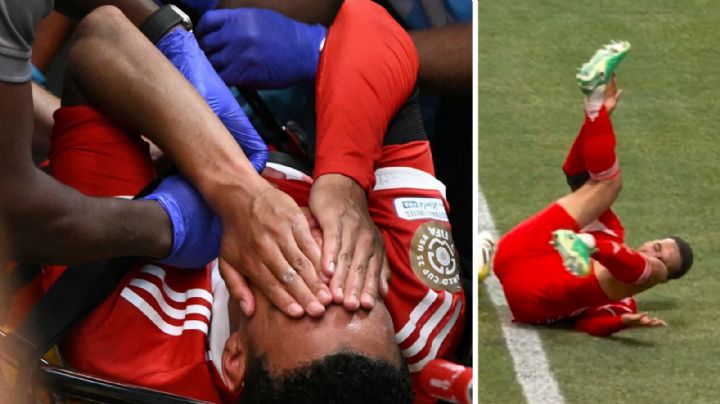 Jamal Musiala será operado en Alemania por fractura ante el PSG