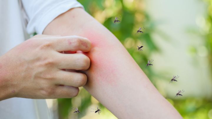 El error de vestimenta que te convierte en blanco de los mosquitos, según expertos