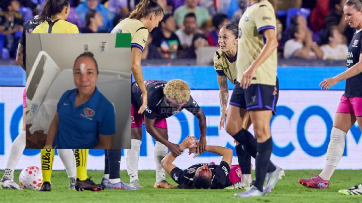Charlyn Corral agradece el apoyo tras fuerte golpe de Mapi León en el Duelo de Estrellas