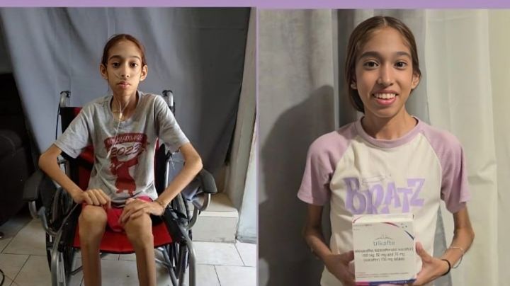 Joven con fibrosis quística organiza boteo para costear tratamiento con Trikafta