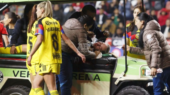 Isa Haas, delantera de América Femeni, será operada tras fractura nasal y conmoción ante Xolos