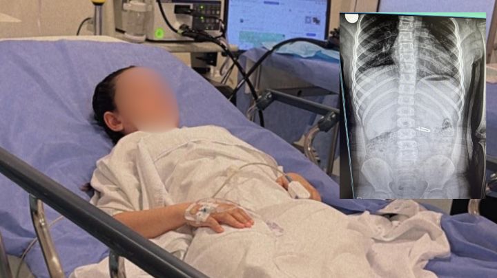 Madre revela estado de salud de su hija tras ingerir candado en Montemorelos