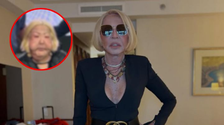 "Laura Bozzo desfigurada" ¿Qué le paso en la cara a la conductora?