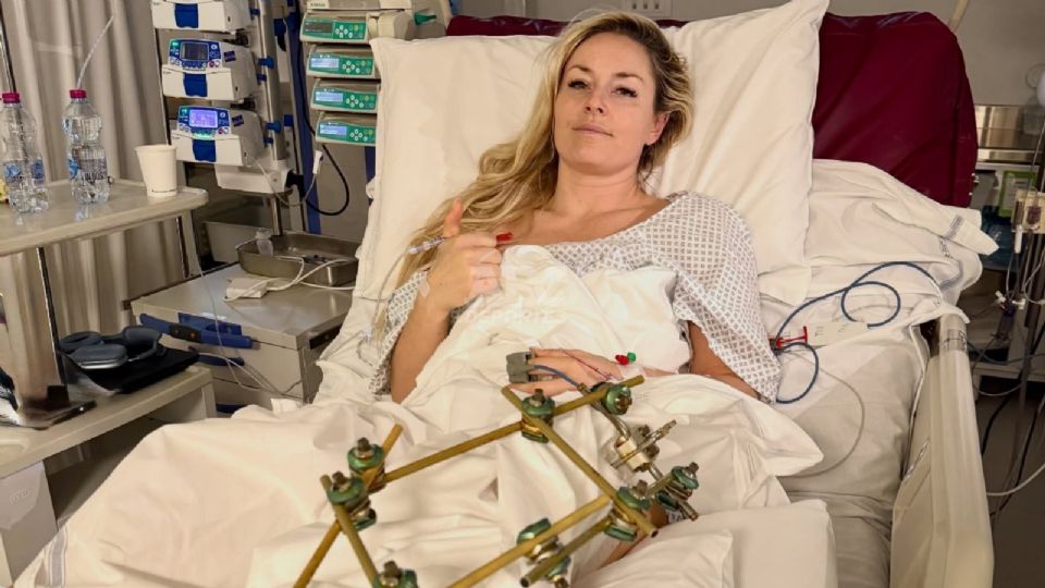 Lindsey Vonn regresa a EU y recibe el alta tras cuatro cirugías por fractura de tibia en Italia