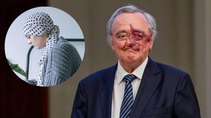 Médicos necesitan 35mdd para aplicar 'cura' del cáncer de páncreas en humanos