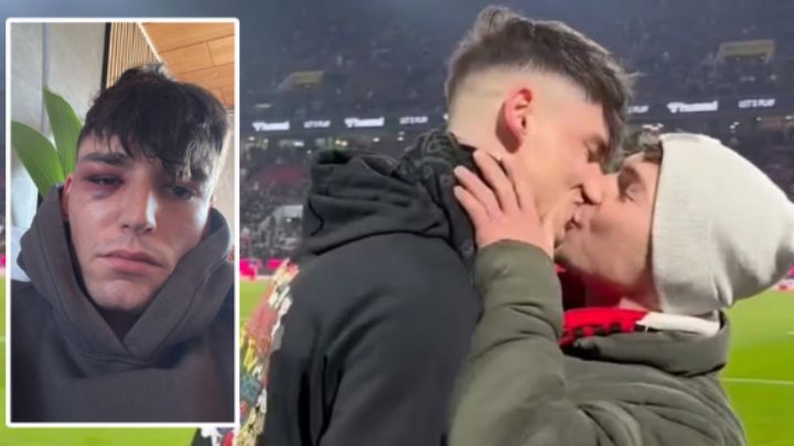 Golpean brutalmente al árbitro Pascal Kaiser quien pidió matrimonio a su novio en estadio