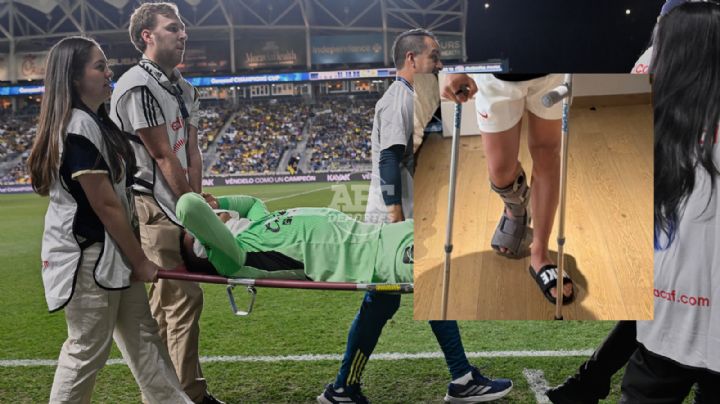 América confirma que Malagón sufrió ruptura del tendón de Aquiles y será operado