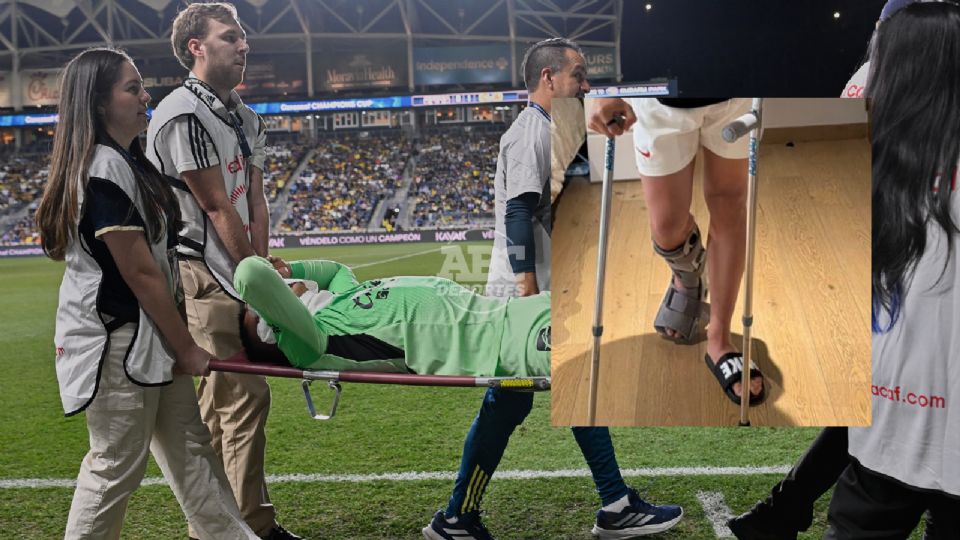 Malagón lesionado en partido de Concacaf