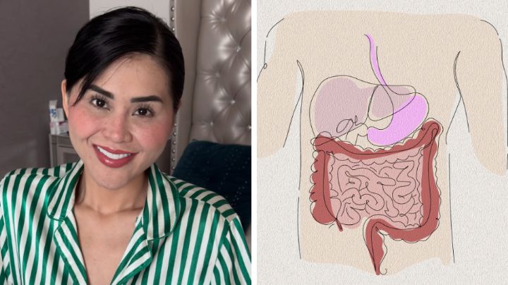 ¿Qué es la hernia de Petersen que afectó la salud de ‘Gomita’?