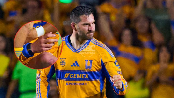 Polémica por dispositivo en la muñeca de Gignac durante el Clásico Regio 142
