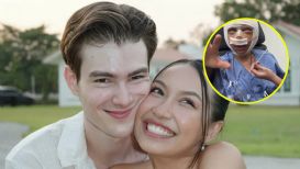 Mujer se somete a cirugía facial tras críticas porque decían que su esposo era muy guapo