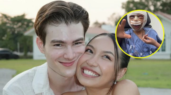 Mujer se somete a cirugía facial tras críticas porque decían que su esposo era muy guapo
