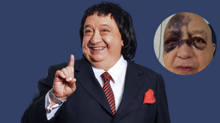 ¿Qué le pasó a Luis de Alba? Reaparece y preocupa por su aspecto físico