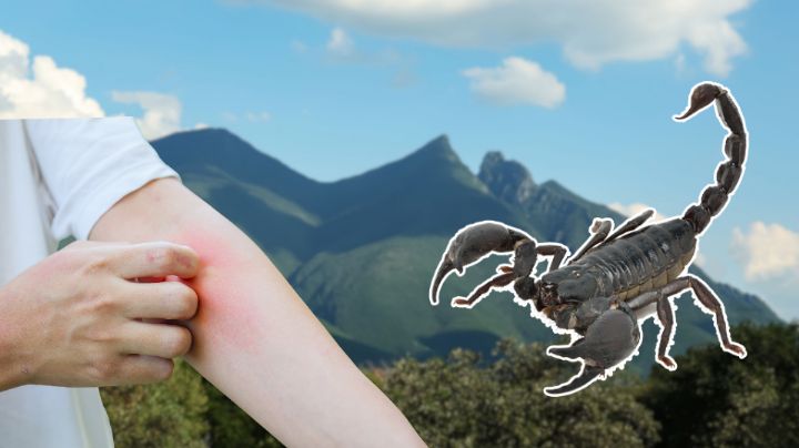 ¿Qué hacer si te pica un alacrán en Nuevo León?