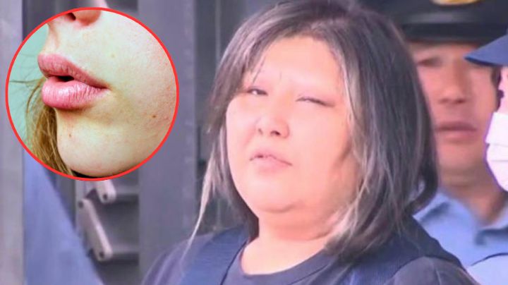 Detienen a mujer por coserle los labios a otra tras discusión en Japón