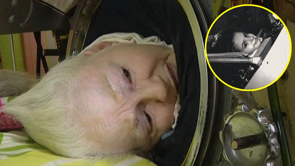 Fallece Martha Lillard, símbolo de supervivencia frente a la poliomielitis