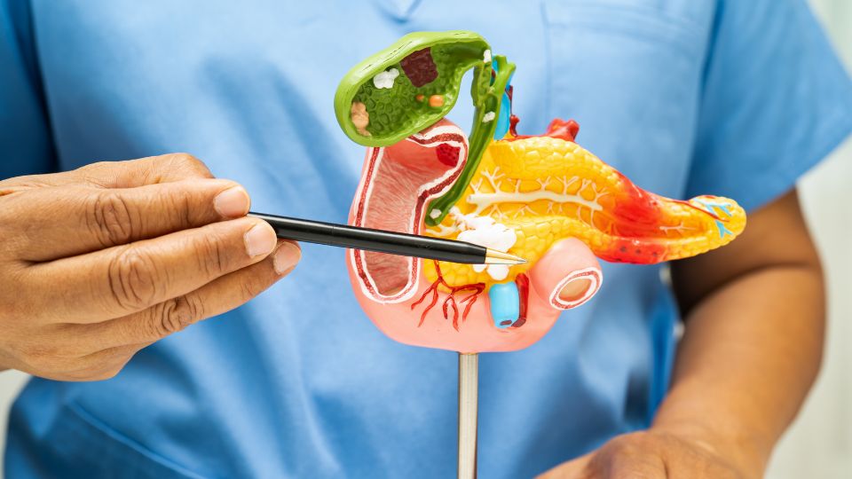 Cáncer de páncreas