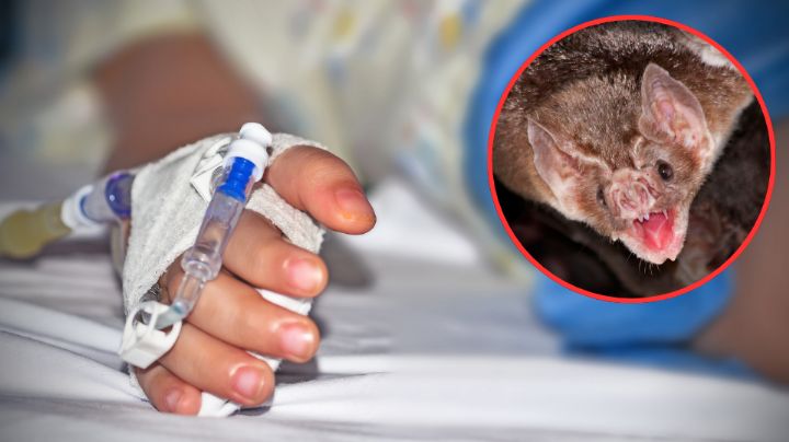 Niño muere de rabia en Canadá; se despertó con un murciélago en la cara