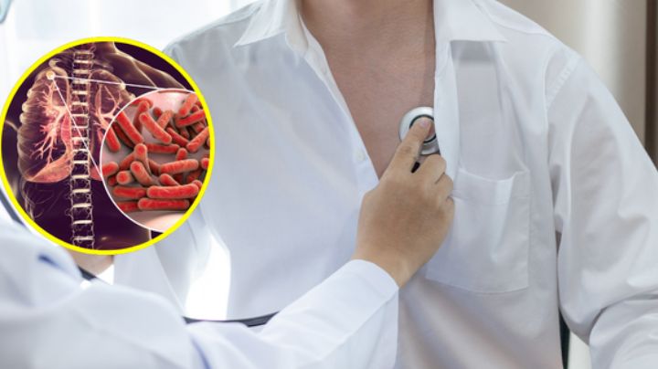 Juárez y Apodaca son los municipios con más casos de tuberculosis, ¿A qué se debe?