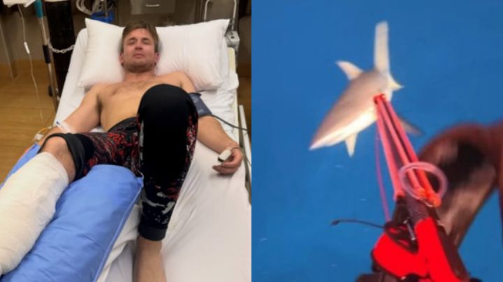 Influencer capta en video momento en que un tiburón ataca su pierna en Fiyi
