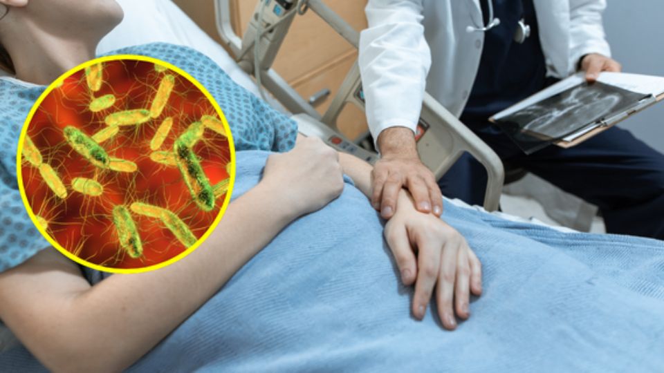 Brote de salmonella (representación).